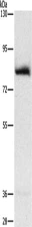 Gel: 8%SDS-PAGE, Lysate: 40 μg, Lane: Human fetal muscle tissue, Primary antibody: AMPD1 Antibody(AMPD1 Antibody) at dilution 1/1600, Secondary antibody: Goat anti rabbit IgG at 1/8000 dilution, Exposure time: 3 secondsRabbit anti-Human AMPD1 Polyclonal Antibody