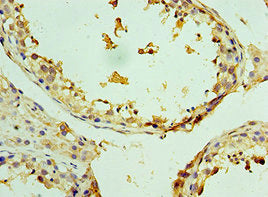 Immunohistochemistry of paraffin-embedded human testis tissue using ZMYND10 Antibody at dilution of 1:100Rabbit anti-Human ZMYND10 Polyclonal Antibody