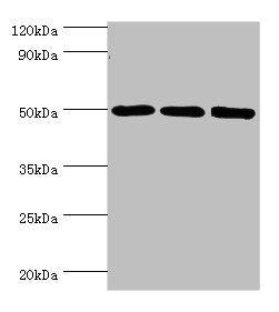 Western blot | All lanes: ZMYND10 antibody at 8μg/ml | Lane 1: A549 whole cell lysate | Lane 2: Mouse kidney tissue | Lane 3: Mouse skeletal muscle tissue | Secondary | Goat polyclonal to rabbit IgG at 1/10000 dilution | Predicted band size: 51, 50 kDa | Observed band size: 51 kDaRabbit anti-Human ZMYND10 Polyclonal Antibody