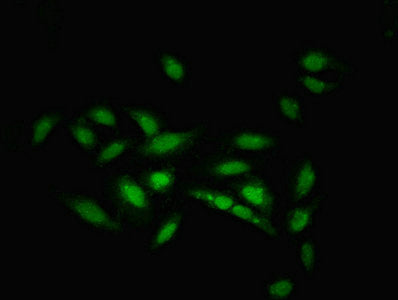 Immunofluorescent analysis of Hela cells using ZNF133 Antibody at dilution of 1:100 and Alexa Fluor 488-congugated AffiniPure Goat Anti-Rabbit IgG(H+L)Rabbit anti-Human ZNF133 Polyclonal Antibody