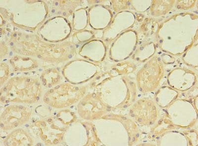 Immunohistochemistry of paraffin-embedded human kidney tissue using ZNF133 Antibody at dilution of 1:100Rabbit anti-Human ZNF133 Polyclonal Antibody