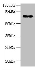 Western blot  | All lanes: ZNF133 antibody at 5µg/ml + Hela whole cell lysate  | Secondary  | Goat polyclonal to rabbit IgG at 1/10000 dilution  | Predicted band size: 74, 63, 67 kDa  | Observed band size: 74 kDaRabbit anti-Human ZNF133 Polyclonal Antibody