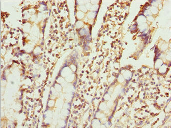Immunohistochemistry of paraffin-embedded human small intestine tissue using ZNF169 Antibody at dilution of 1:100Rabbit anti-Human ZNF169 Polyclonal Antibody