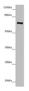 Western blot  | All lanes: ZNF169 antibody at 5.32µg/ml + Hela whole cell lysate  | Secondary  | Goat polyclonal to rabbit IgG at 1/10000 dilution  | Predicted band size: 68 kDa  | Observed band size: 68 kDaRabbit anti-Human ZNF169 Polyclonal Antibody