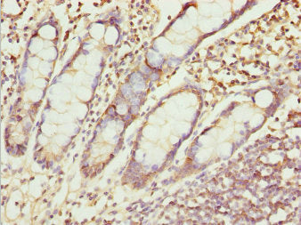 Immunohistochemistry of paraffin-embedded human small intestine tissue using ZNF169 Antibody at dilution of 1:100Rabbit anti-Human ZNF169 Polyclonal Antibody
