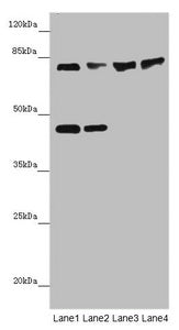 Western blot | All lanes: ZNF169antibody at 2μg/ml | Lane 1: HepG2 whole cell lysate | Lane 2: Hela whole cell lysate | Lane 3: Mouse liver tissue | Lane 4: Mouse kidney tissue | Secondary | Goat polyclonal to rabbit IgG at 1/10000 dilution | Predicted band size: 68 kDa | Observed band size: 68, 45 kDaRabbit anti-Human ZNF169 Polyclonal Antibody