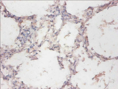 Immunohistochemistry of paraffin-embedded human lung tissue using CYB5R3 Antibody at dilution of 1:100Rabbit anti-Human CYB5R3 Polyclonal Antibody