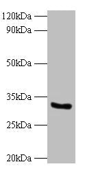 Western blot  | All lanes: CYB5R3 antibody at 2µg/ml + 293T whole cell lysate  | Secondary  | Goat polyclonal to rabbit IgG at 1/10000 dilution  | Predicted band size: 35, 32, 39 kDa  | Observed band size: 32 kDaRabbit anti-Human CYB5R3 Polyclonal Antibody