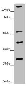 Western blot | All lanes: ZSCAN26antibody at 1.34μg/ml + Mouse brain tissue | Secondary | Goat polyclonal to rabbit IgG at 1/10000 dilution | Predicted band size: 56, 38 kDa | Observed band size: 56, 29, 40, 160 kDaRabbit anti-Human ZSCAN26 Polyclonal Antibody