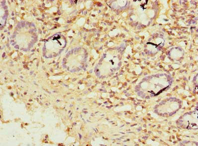Immunohistochemistry of paraffin-embedded human small intestine tissue using ZNF19 Antibody at dilution of 1:100
