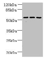 Western blot  | All lanes: ZNF19 antibody at 4µg/ml  | Lane 1: Mouse liver tissue  | Lane 2: MDA-MB-231 whole cell lysate  | Lane 3: HepG2 whole cell lysate  | Secondary  | Goat polyclonal to rabbit IgG at 1/10000 dilution  | Predicted band size: 53, 52 kDa  | Observed band size: 53 kDa