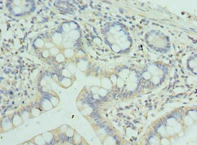 Immunohistochemistry of paraffin-embedded human small intestine tissue using ZSCAN9 Antibody at dilution of 1:100Rabbit anti-Human ZSCAN9 Polyclonal Antibody