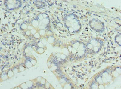Immunohistochemistry of paraffin-embedded human small intestine tissue using ZSCAN9 Antibody at dilution of 1:100Rabbit anti-Human ZSCAN9 Polyclonal Antibody