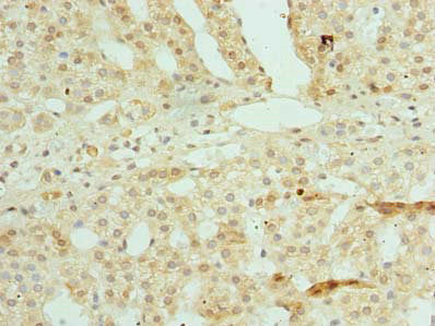 Immunohistochemistry of paraffin-embedded human adrenal gland tissue using ZSCAN9 Antibody at dilution of 1:100Rabbit anti-Human ZSCAN9 Polyclonal Antibody