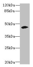 Western blot  | All lanes: ZSCAN9 antibody at 0.3µg/ml + Mouse brain tissue  | Secondary  | Goat polyclonal to rabbit IgG at 1/10000 dilution  | Predicted band size: 46, 52 kDa  | Observed band size: 46 kDaRabbit anti-Human ZSCAN9 Polyclonal Antibody