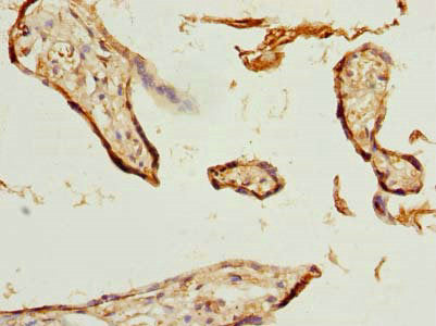 Immunohistochemistry of paraffin-embedded human placenta tissue using ZNF232 Antibody at dilution of 1:100Rabbit anti-Human ZNF232 Polyclonal Antibody