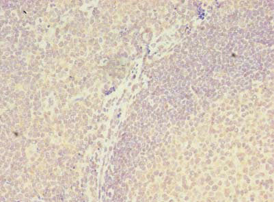 Immunohistochemistry of paraffin-embedded human tonsil tissue using ZBTB18 Antibody at dilution of 1:100