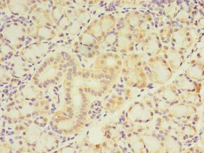 Immunohistochemistry of paraffin-embedded human pancreatic tissue using ZBTB18 Antibody at dilution of 1:100