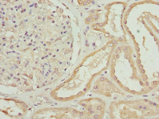 Immunohistochemistry of paraffin-embedded human kidney tissue using ZNF24 Antibody at dilution of 1:100Rabbit anti-Human ZNF24 Polyclonal Antibody