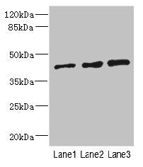 Western blot  | All lanes: ZNF24 antibody at 2.88µg/ml  | Lane 1: 293T whole cell lysate  | Lane 2: Jurkat whole cell lysate  | Lane 3: Hela whole cell lysate  | Secondary  | Goat polyclonal to rabbit IgG at 1/10000 dilution  | Predicted band size: 43, 23 kDa  | Observed band size: 43 kDaRabbit anti-Human ZNF24 Polyclonal Antibody