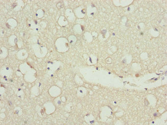 Immunohistochemistry of paraffin-embedded human brain tissue using ZNF264 Antibody at dilution of 1:100Rabbit anti-Human ZNF264 Polyclonal Antibody