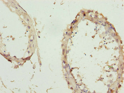 Immunohistochemistry of paraffin-embedded human testis tissue using ZNF264 Antibody at dilution of 1:100Rabbit anti-Human ZNF264 Polyclonal Antibody