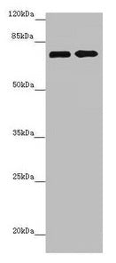 Western blot  | All lanes: ZNF264 antibody at 2.07µg/ml  | Lane 1: Jurkat whole cell lysate  | Lane 2: 293T whole cell lysate  | Secondary  | Goat polyclonal to rabbit IgG at 1/10000 dilution  | Predicted band size: 71 kDa  | Observed band size: 71 kDaRabbit anti-Human ZNF264 Polyclonal Antibody