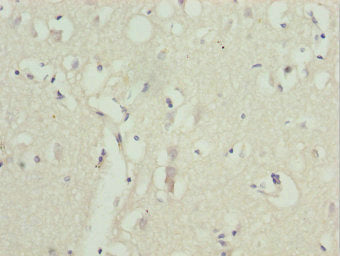 Immunohistochemistry of paraffin-embedded human brain tissue using ZNF264 Antibody at dilution of 1:100Rabbit anti-Human ZNF264 Polyclonal Antibody