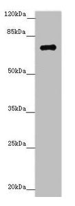 Western blot  | All lanes: ZNF264 antibody at 1.02µg/ml + Jurkat whole cell lysate  | Secondary  | Goat polyclonal to rabbit IgG at 1/10000 dilution  | Predicted band size: 71 kDa  | Observed band size: 71 kDaRabbit anti-Human ZNF264 Polyclonal Antibody