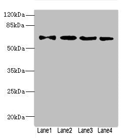 Western blot | All lanes: ZNF324antibody at 1.57μg/ml | Lane 1: A549 whole cell lysate | Lane 2: 293T whole cell lysate | Lane 3: MCF-7 whole cell lysate | Lane 4: Jurkat whole cell lysate | Secondary | Goat polyclonal to rabbit IgG at 1/10000 dilution | Predicted band size: 61 kDa | Observed band size: 61 kDaRabbit anti-Human ZNF324 Polyclonal Antibody