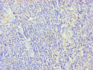 Immunohistochemistry of paraffin-embedded human tonsil tissue using ZNF346 Antibody at dilution of 1:100Rabbit anti-Human ZNF346 Polyclonal Antibody
