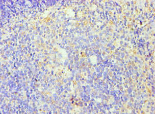 Immunohistochemistry of paraffin-embedded human tonsil tissue using ZNF346 Antibody at dilution of 1:100Rabbit anti-Human ZNF346 Polyclonal Antibody