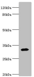 Western blot | All lanes: Zinc finger protein 346 antibody at 3μg/ml + Mouse brain tissue | Secondary | Goat polyclonal to rabbit IgG at 1/10000 dilution | Predicted band size: 33, 36, 30 kDa | Observed band size: 33 kDaRabbit anti-Human ZNF346 Polyclonal Antibody
