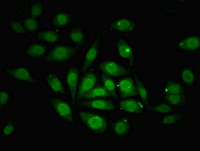 Immunofluorescent analysis of A549 cells using ZNF366 Antibody at dilution of 1:100 and Alexa Fluor 488-congugated AffiniPure Goat Anti-Rabbit IgG(H+L)Rabbit anti-Human ZNF366 Polyclonal Antibody