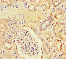 Immunohistochemistry of paraffin-embedded human kidney tissue using the antibody at dilution of 1:100Rabbit anti-Human ZNF366 Polyclonal Antibody
