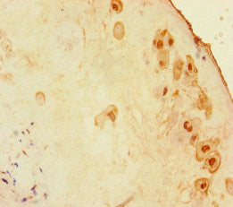 Immunohistochemistry of paraffin-embedded human placenta tissue using ZNF366 Antibody at dilution of 1:100Rabbit anti-Human ZNF366 Polyclonal Antibody