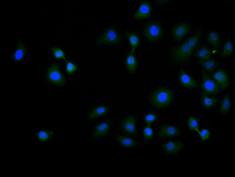 Immunofluorescence staining of Hela cell with ZNF488 Antibody at 1:150, counter-stained with DAPI. The cells were fixed in 4% formaldehyde and blocked in 10% normal Goat Serum. The cells were then incubated with the antibody overnight at 4C. The secondary antibody was Alexa Fluor 488-congugated AffiniPure Goat Anti-Rabbit IgG(H+L).Rabbit anti-Human ZNF488 Polyclonal Antibody