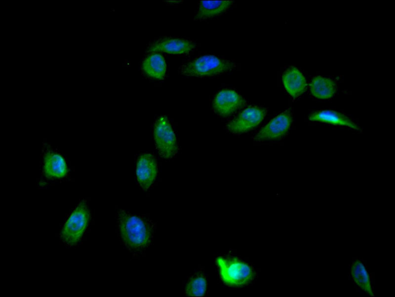 Immunofluorescence staining of Hela cell with ZNF488 Antibody at 1:150, counter-stained with DAPI. The cells were fixed in 4% formaldehyde and blocked in 10% normal Goat Serum. The cells were then incubated with the antibody overnight at 4C. The secondary antibody was Alexa Fluor 488-congugated AffiniPure Goat Anti-Rabbit IgG(H+L).Rabbit anti-Human ZNF488 Polyclonal Antibody