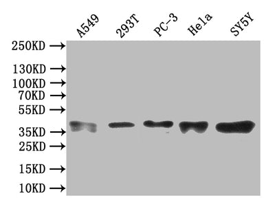 Western Blot Positive WB detected in: A549 whole cell lysate,293T whole cell lysate,PC-3 whole cell lysate,Hela whole cell lysate,SY5Y whole cell lysate All lanes: ZNF488 antibody at 1:1000 Secondary Goat polyclonal to rabbit IgG at 1/50000 dilution Predicted band size: 37 kDa Observed band size: 37 kDaRabbit anti-Human ZNF488 Polyclonal Antibody