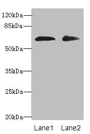 Western blot  | All lanes: ZNF529 antibody at 6µg/ml  | Lane 1: Hela whole cell lysate  | Lane 2: MCF-7 whole cell lysate  | Secondary  | Goat polyclonal to rabbit IgG at 1/10000 dilution  | Predicted band size: 66 kDa  | Observed band size: 66 kDaRabbit anti-Human ZNF529 Polyclonal Antibody