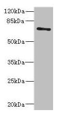 Western blot  | All lanes: ZNF549 antibody at 1.09µg/ml + A549 whole cell lysate  | Secondary  | Goat polyclonal to rabbit IgG at 1/10000 dilution  | Predicted band size: 75, 73 kDa  | Observed band size: 75 kDaRabbit anti-Human ZNF549 Polyclonal Antibody