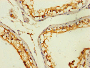 Immunohistochemistry of paraffin-embedded human testis tissue using ZNF562 Antibody at dilution of 1:100Rabbit anti-Human ZNF562 Polyclonal Antibody