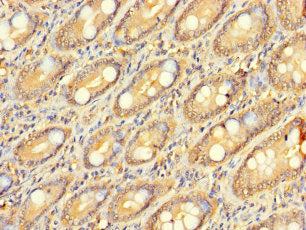 Immunohistochemistry of paraffin-embedded human small intestine tissue using ZNF562 Antibody at dilution of 1:100Rabbit anti-Human ZNF562 Polyclonal Antibody