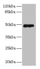 Western blot  | All lanes: ZNF562 antibody at 12µg/ml + 293T whole cell lysate  | Secondary  | Goat polyclonal to rabbit IgG at 1/10000 dilution  | Predicted band size: 49, 41 kDa  | Observed band size: 49 kDaRabbit anti-Human ZNF562 Polyclonal Antibody