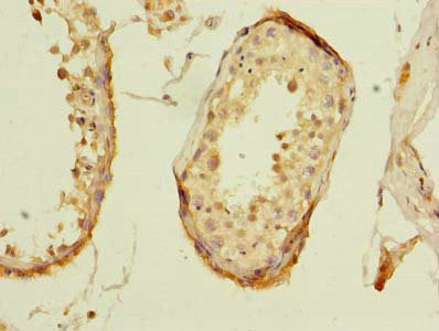 Immunohistochemistry of paraffin-embedded human testis tissue using ZNF614 Antibody at dilution of 1:100Rabbit anti-Human ZNF614 Polyclonal Antibody