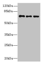Western blot  | All lanes: ZNF614 antibody at 6µg/ml  | Lane 1: Jurkat whole cell lysate  | Lane 2: HepG2 whole cell lysate  | Lane 3: A549 whole cell lysate  | Secondary  | Goat polyclonal to rabbit IgG at 1/10000 dilution  | Predicted band size: 68, 23 kDa  | Observed band size: 68 kDaRabbit anti-Human ZNF614 Polyclonal Antibody