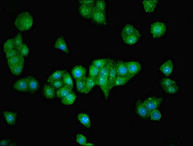 Immunofluorescent analysis of PC-3 cells using ZNF624 Antibody at dilution of 1:100 and Alexa Fluor 488-congugated AffiniPure Goat Anti-Rabbit IgG(H+L)