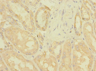 Immunohistochemistry of paraffin-embedded human kidney tissue using the antibody at dilution of 1:100