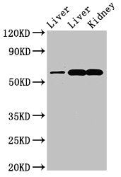 Western Blot | Positive WB detected in: Rat liver tissue, Mouse liver tissue, Mouse kidney tissue | All lanes: ZNF695 antibody at 3.4μg/ml | Secondary | Goat polyclonal to rabbit IgG at 1/50000 dilution | Predicted band size: 61, 21, 16, 11 kDa | Observed band size: 61 kDaRabbit anti-Human ZNF695 Polyclonal Antibody