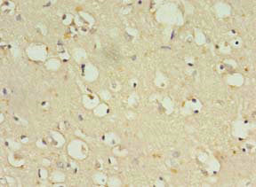Immunohistochemistry of paraffin-embedded human brain tissue using ZNF699 Antibody at dilution of 1:100Rabbit anti-Human ZNF699 Polyclonal Antibody